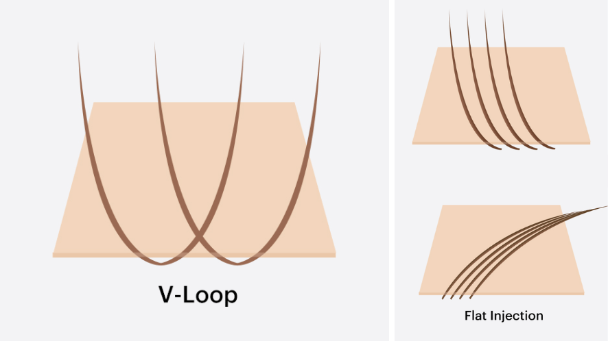 v-loop ventilation vs. injected ventilation