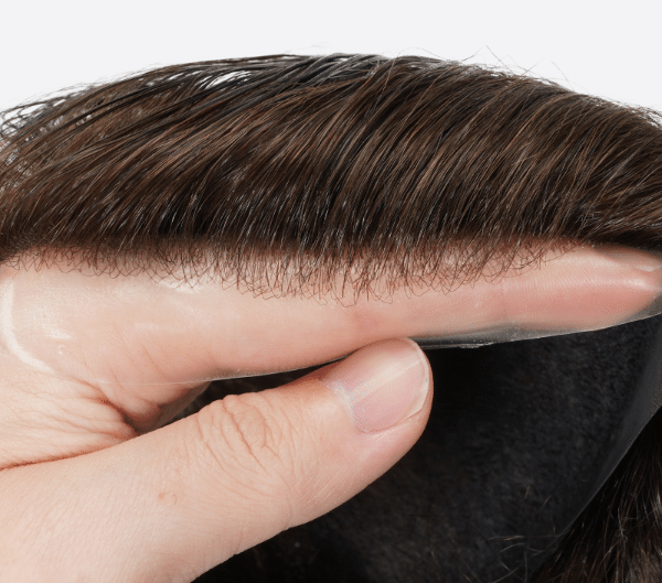 close up of flat injection hairline